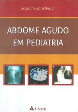 Imagem de ABDOME AGUDO EM PEDIATRIA