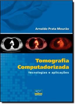 Imagem de TOMOGRAFIA COMPUTADORIZADA - TECNOLOGIAS E APLICACOES