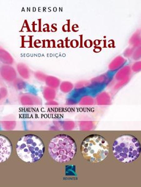 Picture of ANDERSON - ATLAS DE HEMATOLOGIA - 2ª ED