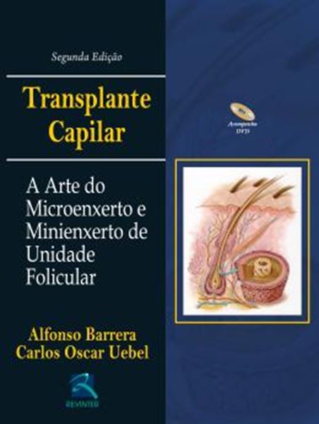 Picture of TRANSPLANTE CAPILAR - A ARTE DO MICRO E MINIENXERTO DA UNIDADE FOLICULAR