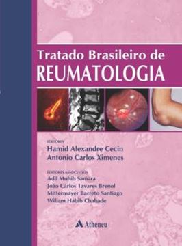 Imagem de TRATADO BRASILEIRO DE REUMATOLOGIA