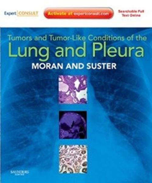 Picture of TUMORS AND TUMOR-LIKE CONDITIONS