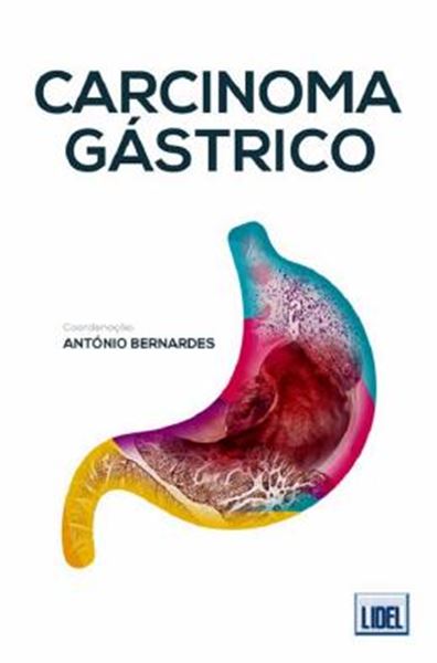 Picture of CARCINOMA GASTRICO