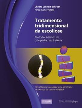 Imagem de TRATAMENTO TRIDIMENSIONAL DA ESCOLIOSE - METODO SCHROTH DE ORTOPEDIA RESPIRATORIA