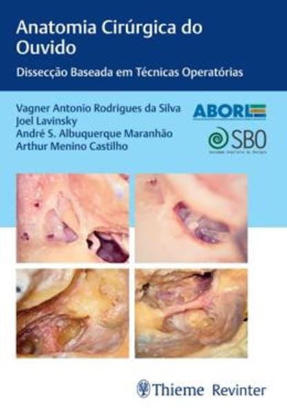 Picture of ANATOMIA CIRURGICA DO OUVIDO