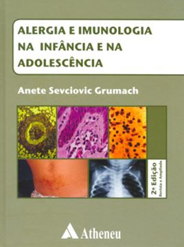 Imagem de ALERGIA E IMUNOLOGIA NA INFANCIA E NA ADOLESCENCIA - 2ª EDICAO