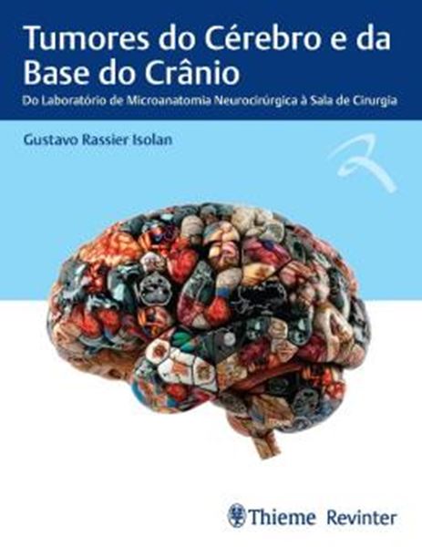 Picture of TUMORES DO CEREBRO E DA BASE DO CRANIO - DO LABORATORIO DE MICROANATOMIA NEUROCIRURGICA A SALA DE CIRURGIA
